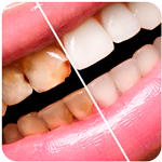 Odontología restauradora